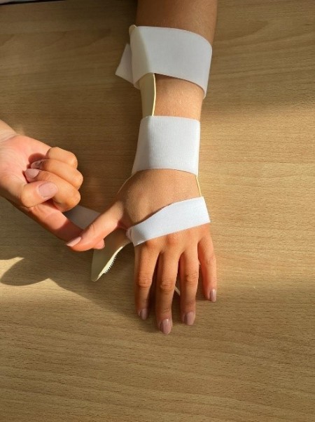 A. Using your other hand, Lift your thumb straight off the splint